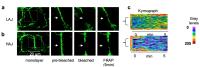 Live confocal images of lung endothelial cells show regions of low (LAJ) and high (HAJ) cadherin density.